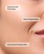 CMT Post-Procedure Cream